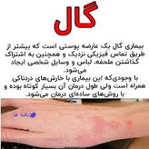 کرم ویتامین e و الوعه ورا برند ویتابلا خارجی درمان بیماری گال دوره دوماهه دوعدد کرم